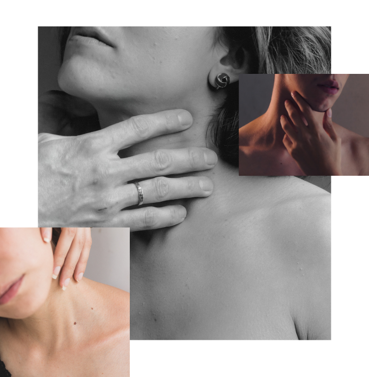 Three images interlocked, showing the thyroid area.