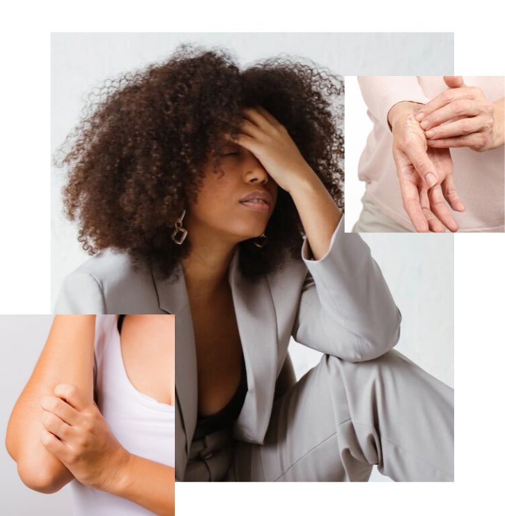 Three people with psoriasis.